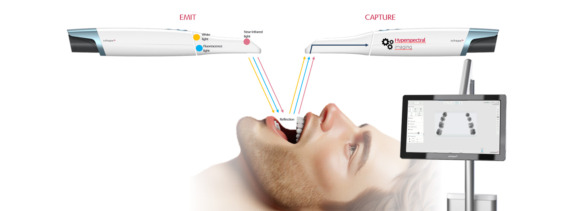 Harmony Dental Studio | Dental Bridges, Root Canals and Dentures
