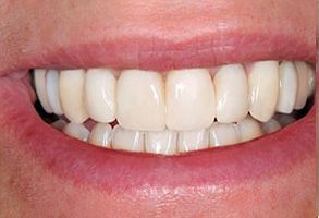 Harmony Dental Studio | Teeth Whitening, Extractions and Implant Dentistry