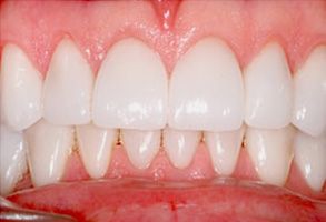 Harmony Dental Studio | Dentures, Teeth Whitening and Emergency Treatment