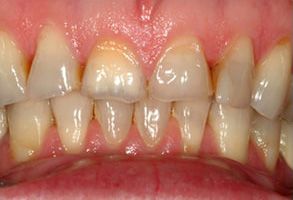 Harmony Dental Studio | Emergency Treatment, Dental Bridges and Crowns  amp  Caps