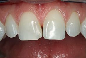 Harmony Dental Studio | Invisalign reg , Dentures and Extractions